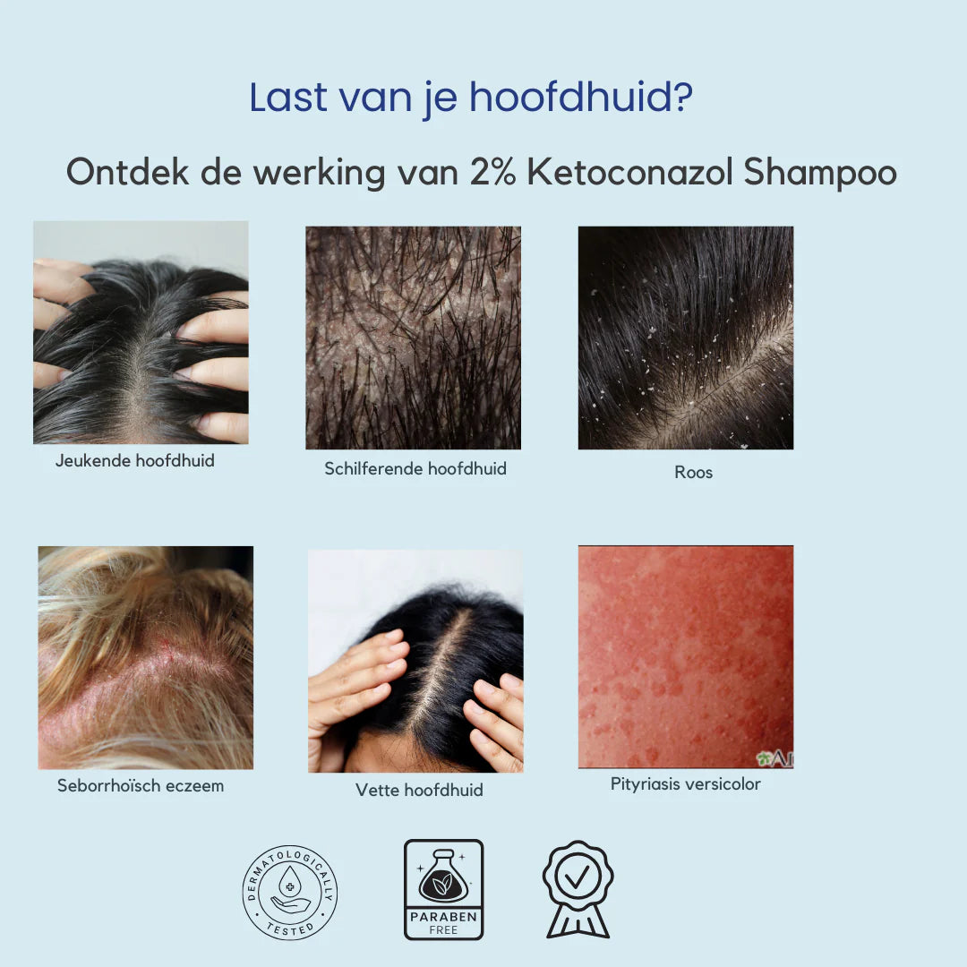 Ketoconazol Shampoo – Milde Verzorging bij Schilfers, Jeuk & Gevoelige Hoofdhuid